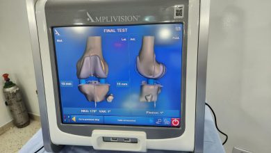 Dr Mauro Junior- A evolução Prótese Navegada Prótese Robótica de joelho