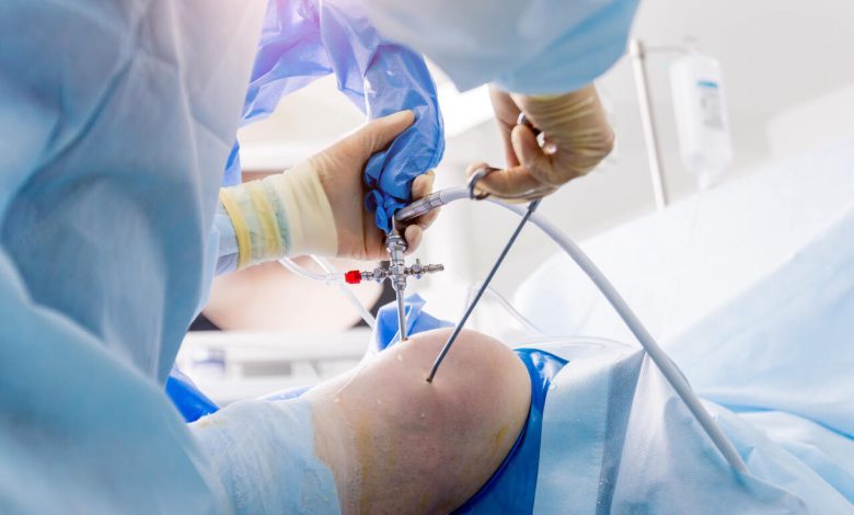 Como funciona a artroscopia do joelho?