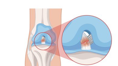 Você sabe que os sintomas podem variar a depender do ligamento dojoelho lesado