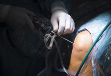 Ortopedista Especialista em Joelho Goiânia - A importância da equipe multidisciplinar no tratamento cirúrgico