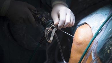 Ortopedista Especialista em Joelho Goiânia - A importância da equipe multidisciplinar no tratamento cirúrgico