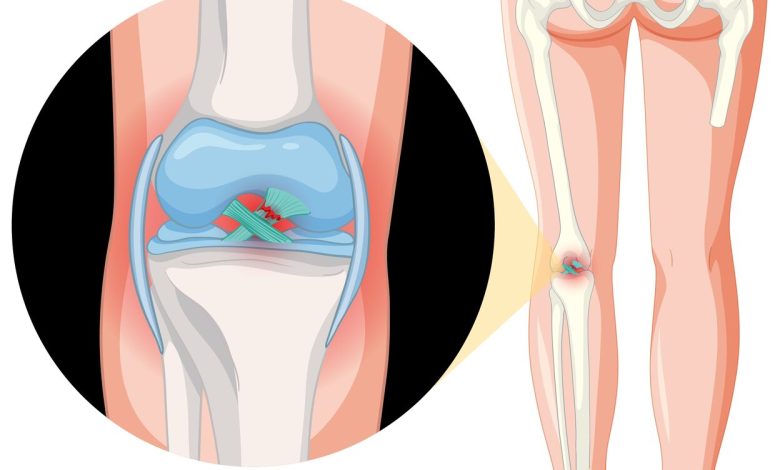 Quais as consequências da lesão do ligamento cruzado posterior do joelho