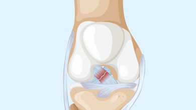 Como identificar uma Lesão no Ligamento Cruzado Anterior (LCA) do joelho?