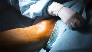 Dicas para se preparar para uma cirurgia de joelho