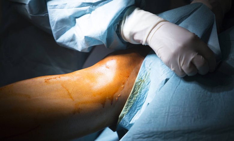 Dicas para se preparar para uma cirurgia de joelho