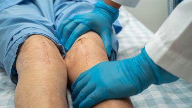 Prótese bilateral de joelho o que é e quais as vantagens