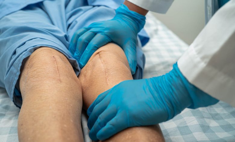 Prótese bilateral de joelho o que é e quais as vantagens