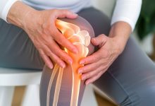 Diferença clínica entre condropatia patelar e artrose precoce