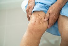 Quais sintomas são sinais de alerta no pós operatório da cirurgia de prótese de joelho?