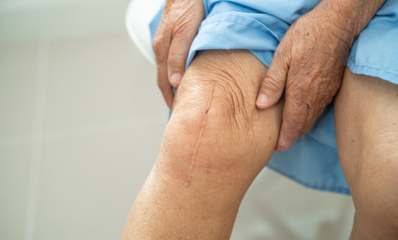 Quais sintomas são sinais de alerta no pós operatório da cirurgia de prótese de joelho?