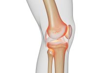 Quais os principais sintomas de lesão da cartilagem e quando é necessário tratamento