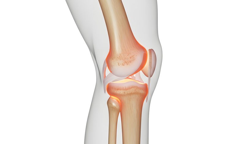 Quais os principais sintomas de lesão da cartilagem e quando é necessário tratamento